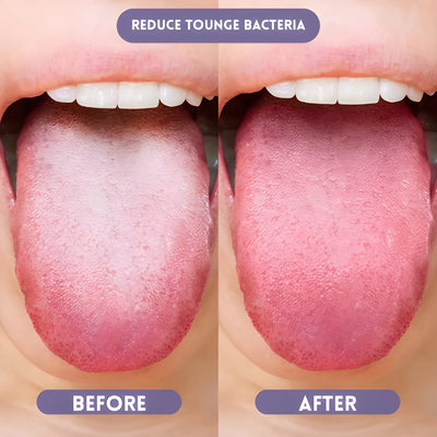 Fresq Probiotic Oral Spray
